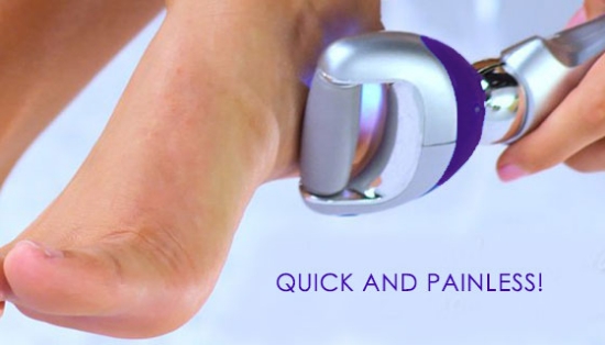 Easily remove callus and other abrasions with the PedEgg Powerball Callus Remover which is available today at a huge savings!