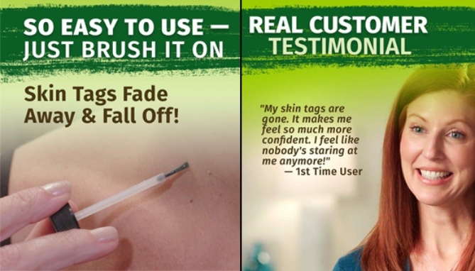 Picture 4 of ENDtag Skin Tag Remover - 3 Bottles