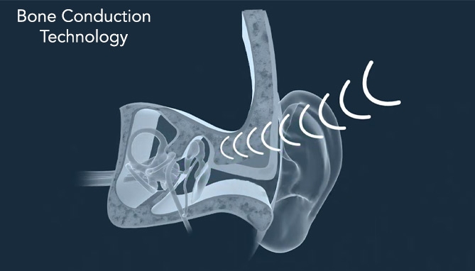 Picture 2 of Osso Bone Conduction Open-Ear Headphones