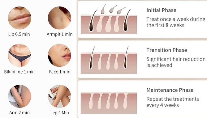 Picture 3 of Pulse Perfect Pro IPL Hair Removal System