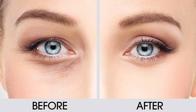 Picture 5 of Line Eraser - The 90 Second Wrinkle Reducer